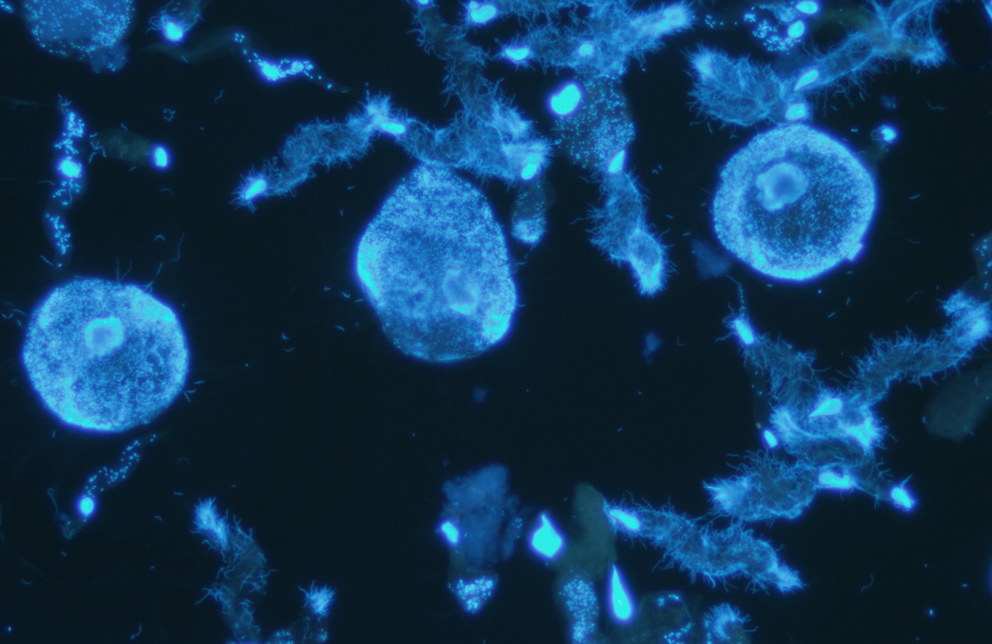 シロアリ腸内微生物（DAPI）