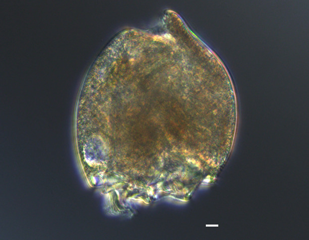 ウシルーメン微生物（位相差）